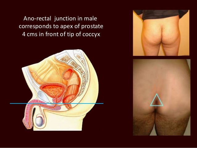 Area above anus photo 517